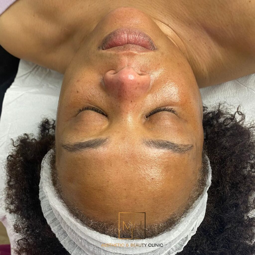 www.mhaestheticclinic.com 0121 3552162 (6)