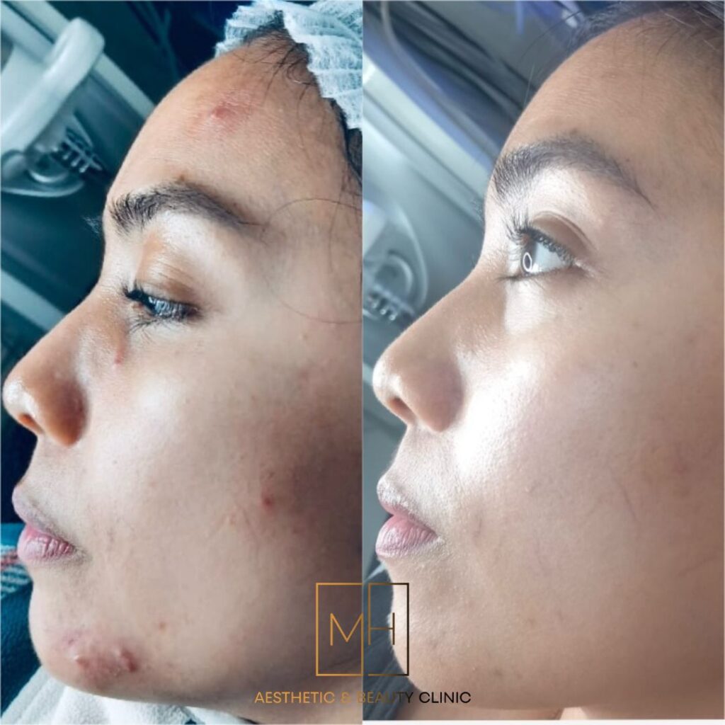 www.mhaestheticclinic.com 0121 3552162 (10)
