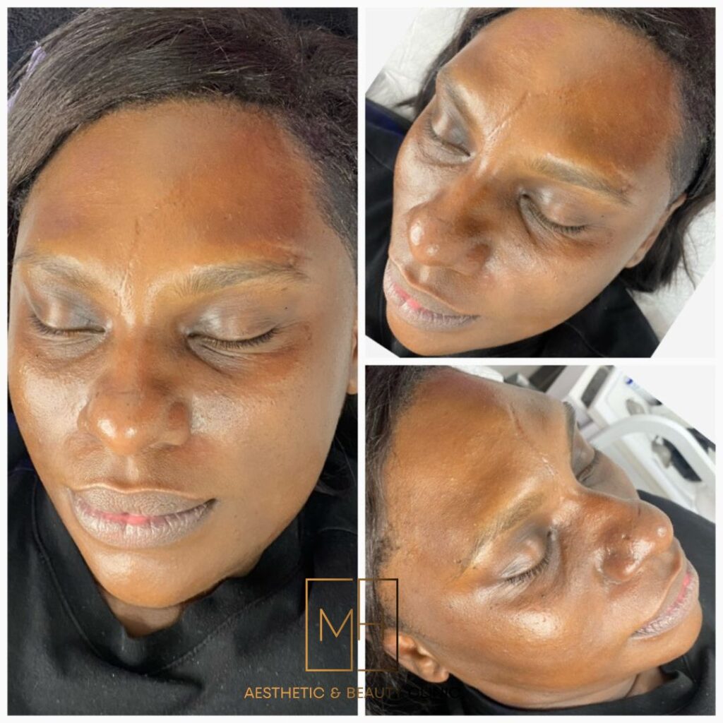 www.mhaestheticclinic.com 0121 3552162 (7)